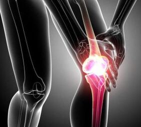 Knee pain during arthritis and osteoarthritis