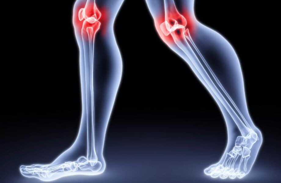 The pain of the joints