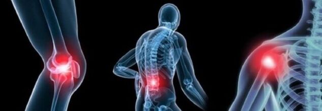Types of pain in arthrosis