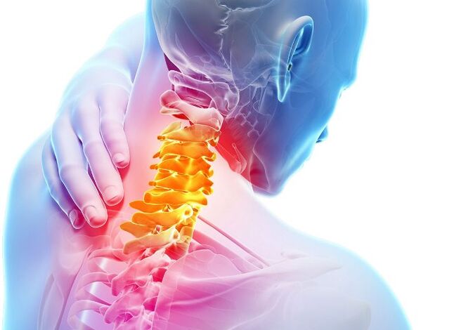 Symptoms and stages of developing cervical osteochondrosis